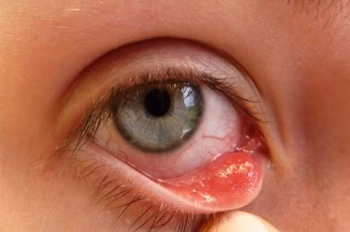 附图。（图片来源：互联网）