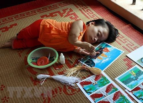 资料图:越南橙剂受害者。 图自越通社 资料图:越南橙剂受害者。 图自越通社