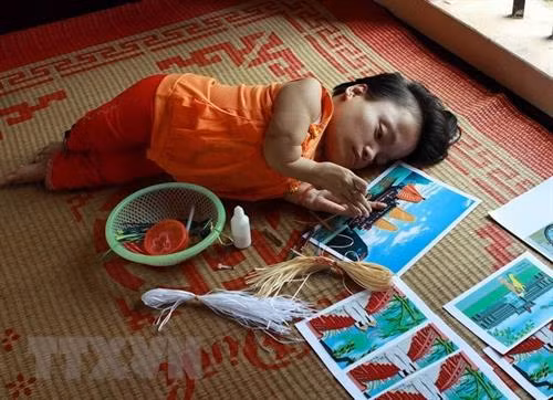 资料图：越南橙剂受害者。 图自越通社