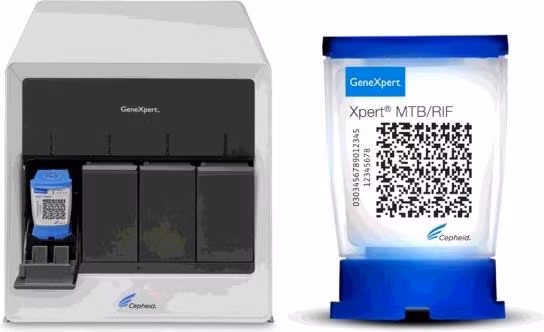 结核病防治计划Gene Xpert 检测系统可参与新冠肺炎病毒检测