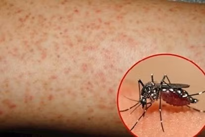 今年前10月全国累计报告登革热病例达8.4万例 ảnh 1